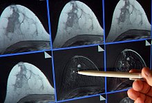 Mammographie - Jan-Peter Kasper/dpa-Zentralbild/dpa