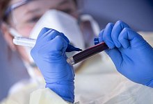 Corona - Foto: Marijan Murat/dpa