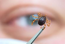 Eine Haarige Hyalomma-Zecke - Marijan Murat/dpa/dpa-tmn