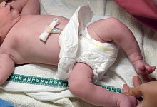 Hebammen fürchten weitere Kreißsaalschließungen - Waltraud Grubitzsch/dpa