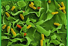 Listerien - Foto: Manfred Rohde/Helmholtz-Zentrum f&uuml;r Infektionsforschung/dpa