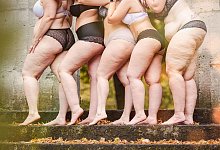 Frauen mit Lipödem-Erkrankung an Beinen - Carina Gorny Fotografie/Lipödem-Gesellschaft/dpa