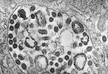 Marburg-Virus - Fred Murphy/CDC/dpa