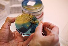 Gewebeproben - Foto: &Oslash;rn E. Borgen/NTB scanpix