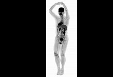 Ganzk&ouml;rper-3D-Scanner - Foto: UC Davis and Zhongshan Hospital/Shanghai