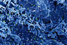 Affenpockenvirus - Niaid/Niaid/Planet Pix via ZUMA Press Wire/dpa