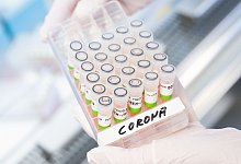 Gef&auml;&szlig; mit aufbereiteten PCR-Tests auf das Coronavirus - Julian Stratenschulte/dpa/Symbolbild
