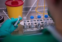 Nur bei F&auml;llen, bei denen ein begr&uuml;ndeter Verdacht auf das Coronavirus bestehe, sei ein Test sinnvoll, so die Experten aus dem Kreis G&uuml;tersloh. - Symbolfoto/picture alliance