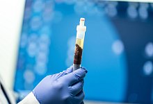 Blutprobe - Symbolbild - Silas Stein/dpa