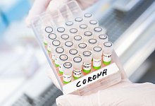 Gef&auml;&szlig; mit aufbereiteten PCR-Tests auf das Coronavirus - Julian Stratenschulte/dpa/Symbolbild