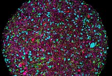 Hirnorganoid - Thomas Hartung/Johns Hopkins University/dpa