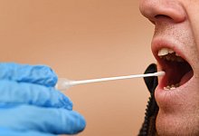 DNA-Test - Stefan Sauer/dpa