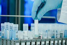 PCR-Test - Foto: Uwe Anspach/dpa