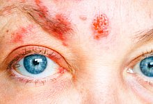 adobestock_438236753 - 1 - lganz - stock.adobe.com