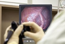 09 02 2010 Deutschland Darmspiegelung im Krankenhaus Ein Aerzteteam untersucht den Dickdarm eine - 1 - imago/Rupert Oberhäuser