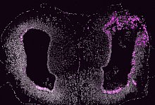 Teil des Axolotl-Vorderhirns zwei Wochen nach einer dorsalen Schnittverletzung in der rechten Hemisph&auml;re. Die Zellen schlie&szlig;en die Verletzungsstelle (magenta). - Katharina Lust/IMP/dpa