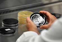 Petrischale mit Proben von Legionellen - Federico Gambarini/dpa/dpa-tmn