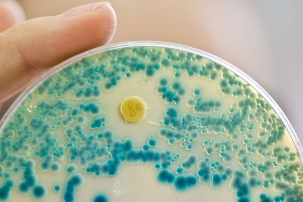 Indikatorkulturplatte zum Nachweis von resistenten Bakterien: Antibiotikaresistente Keime verursachen allein in der EU jährlich Zehntausende Todesfälle. (Symbolbild) - © Daniel Karmann/dpa