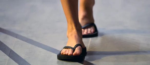 Flipflops sind sehr minimalistische Schuhe, was bei dauerhaftem Tragen eine Fußfehlstellung verschlimmern kann. - © Soeren Stache/dpa/dpa-tmn