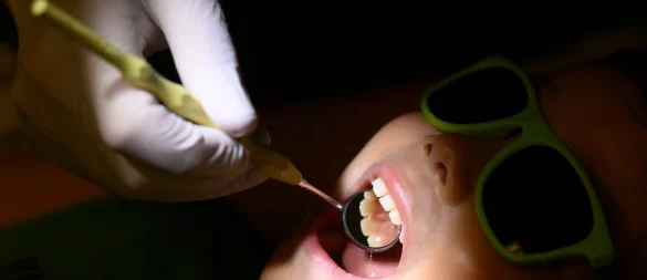 Gesetzliche Krankenkassen übernehmen regelmäßige Zahnarztchecks. - © Julian Stratenschulte/dpa/dpa-tmn