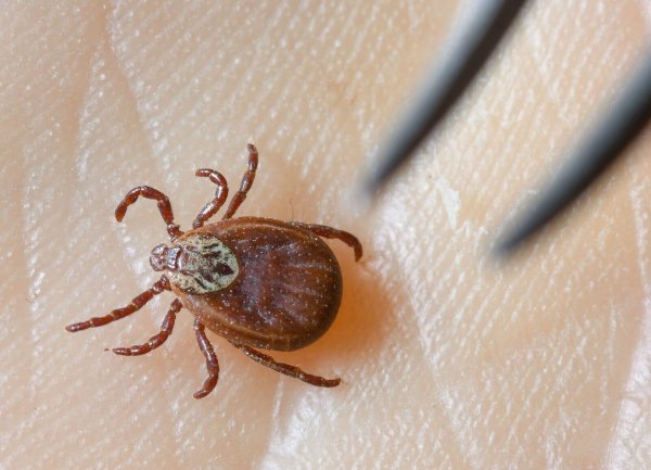 Zecken übertragen FSME und Borreliose. (Archivbild) - © Patrick Pleul/dpa-Zentralbild/dpa