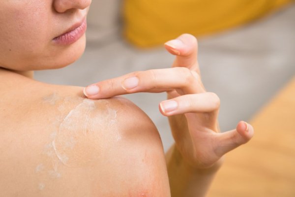 Eine Frau versorgt ihre Haut mit einer Creme - © Foto: Christin Klose/dpa-tmn