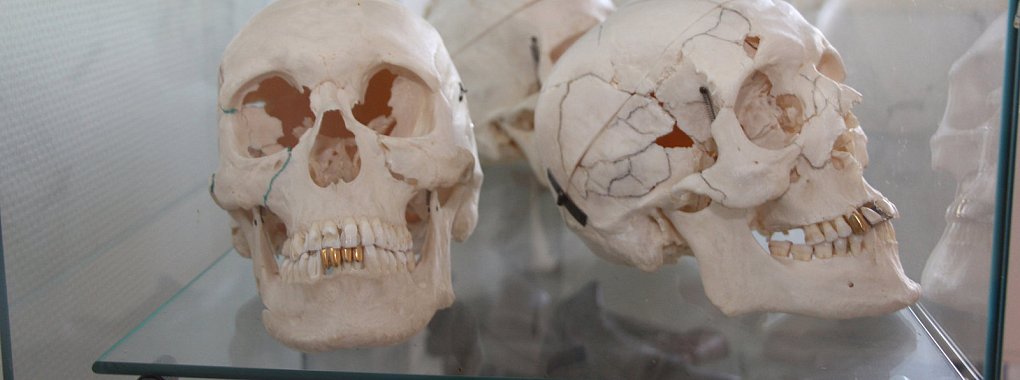 In einer Vitrine im Institut für Rechtsmedizin in Münster sind einige Exponate unter anderem mit Schussverletzungen zu sehen. - © Freya Köhring