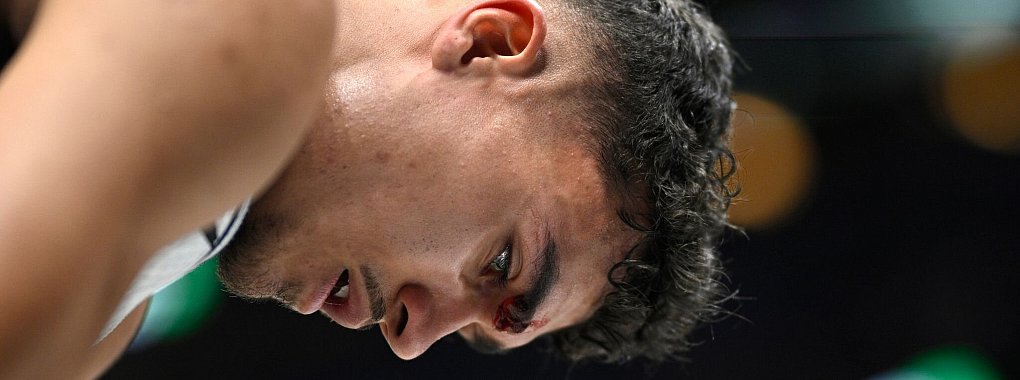Tristan Da Silva musste nach einem Ellenbogentreffer genäht werden. - © Phelan M. Ebenhack/AP/dpa
