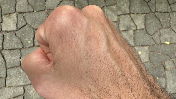 Bei einer Auseinandersetzung in der Innenstadt wurde ein 32-Jähriger zunächst lebensgefährlich verletzt. - © Sven Kienscherf