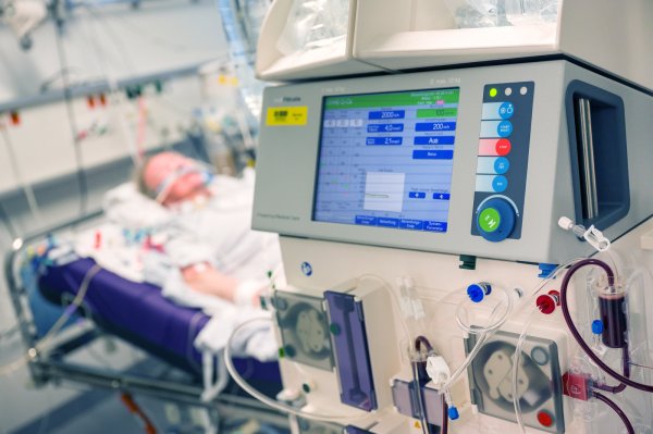 Ein Patient liegt in einem Intensivzimmer – hier ein Foto aus Bayern – an einem Beatmungsgerät und einem Dialysegerät (im Vordergrund). Beatmungsgeräte gelten in der Corona-Krise als essenziell für die Behandlung von Covid-19-Patienten. - © Peter Kneffel/dpa