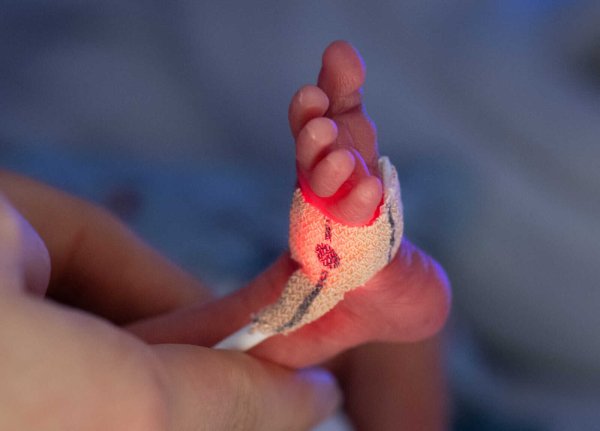 Frühgeborene, die weniger als 1.250 Gramm wiegen, dürfen künftig nur noch in drei Krankenhäusern in OWL versorgt werden. - © picture alliance/dpa
