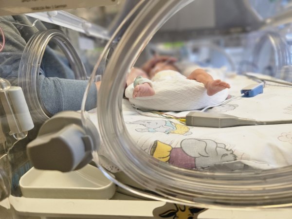 Per Notkaiserschnitt kam dieses kleine Baby in der der 27. Schwangerschaftswoche mit knapp 1000 Gramm zur Welt. Zum Zeitpunkt des Fotos lag das Frühchen schon vier Wochen im Inkubator. - © Janet König
