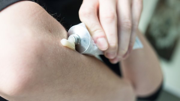 Cortisonhaltige Salbe kann bei Rheuma helfen. - © picture alliance/dpa