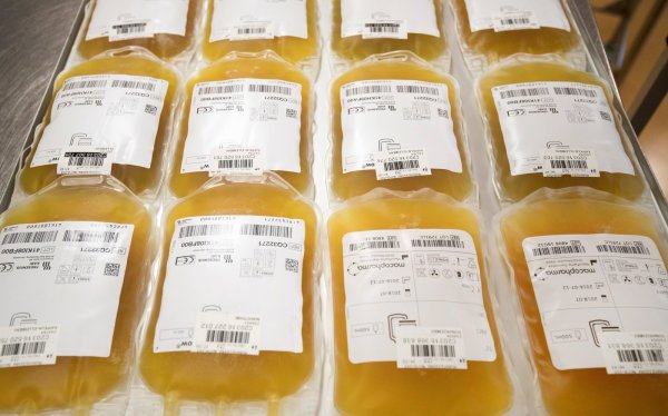 In dem Blutplasma von genesenen Covid-19-Patienten lassen sich Antikörper nachweisen, die Schwerkranken helfen können. - © dpa