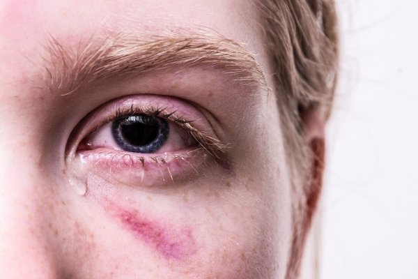 Ein Trauma kann die Seele lange belasten. - © Symbolbild: Pixabay