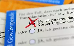 Mit einem Organspendeausweis kann jeder seine Entscheidung für oder gegen eine Organspende einfach dokumentieren. - © picture alliance/dpa