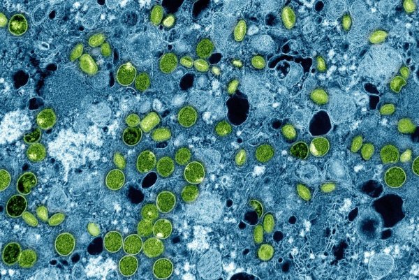 So sehen die Mpox-Viruspartikel unter dem Mikroskop aus. (Archivbild) - © -/NIAID via AP/dpa