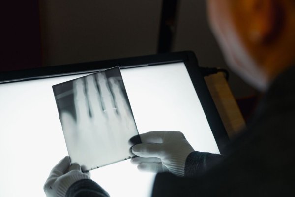 Ein Röntgenbild der Hand von Wilhelm Röntgen gehört nun zum Unesco-Weltdokumentenerbe. (Archivbild) - © Marius Becker/dpa