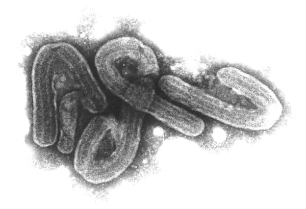 Eine elektronenmikroskopische Aufnahme des Marburg-Virus. (Archivbild) - © Bernhard-Nocht-Institut/dpa