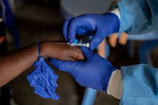 Die Zahl der Mpox-Fälle nimmt in mehreren afrikanischen Ländern weiter zu (Archivbild). - © Moses Sawasawa/AP/dpa