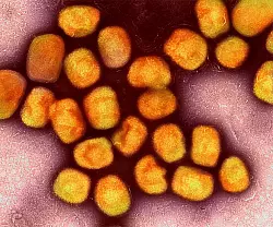 In Deutschland ist zum zweiten Mal die neue Variante des Mpox-Virus nachgewiesen worden, vier Mitglieder einer Familie im Rheinisch-Bergischen Kreis bei Köln sind erkrankt (Archivbild). - © Niaid/Niaid/Planet Pix via ZUMA Press Wire/dpa