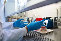 Die Häufung weckt Erinnerungen an einen Ausbruch in Deutschland im Jahr 2011, bei dem rund 3.800 Erkrankungen erfasst wurden und mehr als 50 Menschen starben. (Archivbild) - © Guido Kirchner/dpa