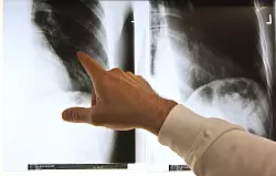 Patientensch&uuml;tzer sind &uuml;ber die geplanten Neuregelungen bei der &Auml;rztewahl besorgt. (Archivbild) - &copy; Arno Burgi/dpa-Zentralbild/dpa