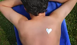 Bei diesem Trend sehen Hautärzte rot: Junge Leute legen sich derzeit Schablonen auf die Haut - und lassen sich dann absichtlich von der Sonne verbrennen. Gewünschtes Ergebnis: ein zeitlich befristetes Tattoo. Tatsächliches Ergebnis: ein Sonnenbrand. - © Karl-Josef Hildenbrand/dpa/dpa-tmn