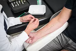 Um die Allergiesymptome gut behandeln zu können, braucht es im ersten Schritt eine Diagnostik. - © Christin Klose/dpa-tmn