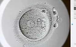 Ein Zweizeller nach einer k&uuml;nstlichen Befruchtung. Entwickelt er sich gut, kann er in die Geb&auml;rmutter transferiert werden. - &copy; Jens Kalaene/dpa