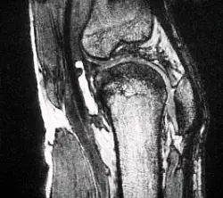 Schmerzen im Knie treiben viele Versicherte zum Orthopäden - viele kommen dort mit fragwürdigen Therapien in Kontakt. (Archivbild) - © picture alliance / dpa