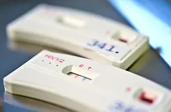 Ein Schnelltest hilft bein der Erkennung einer HIV-Infektion. (Aschivbild) - &copy; Britta Pedersen/dpa-Zentralbild/dpa