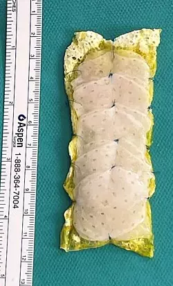 Das «Herzpflaster» wird aus Einzelteilen zusammengesetzt. - © ---/Universitätsmedizin Göttingen/dpa