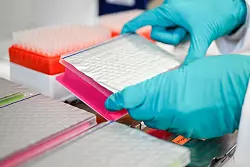 Am Universitätsklinikum Heidelberg wird für Babys das Neugeborenen-Screening angeboten - und zum Genomischen Neugeborenen-Screening geforscht. - © Uwe Anspach/dpa